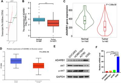 Downregulated ADARB1 Facilitates Cell Proliferation, Invasion and has Effect on the Immune Regulation in Ovarian Cancer